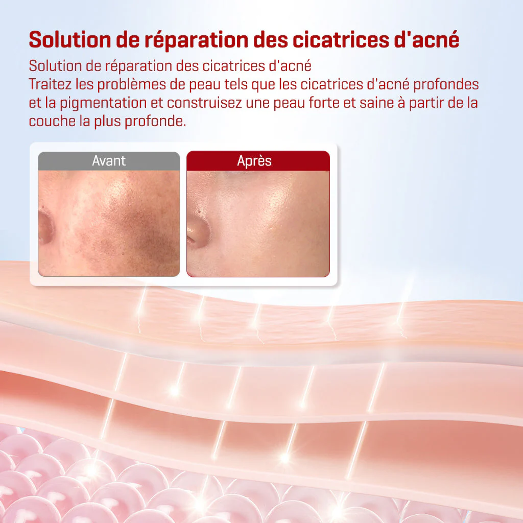 SNAIL TRUECICA MIRACLE REPAIR TONER 150ML - Image 4