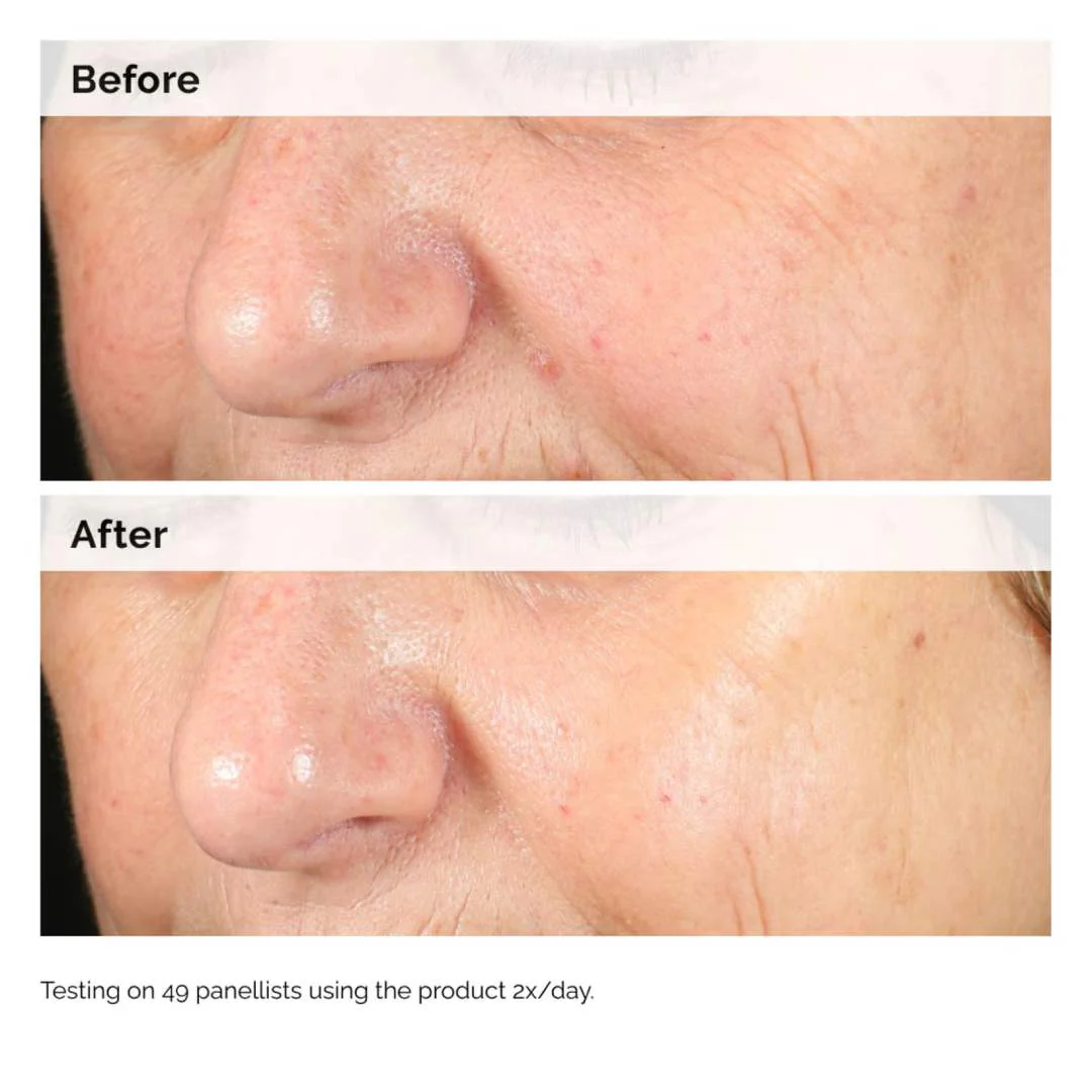 THE ORDINARY - Alpha Arbutin 2% + HA - 30ml - Image 5